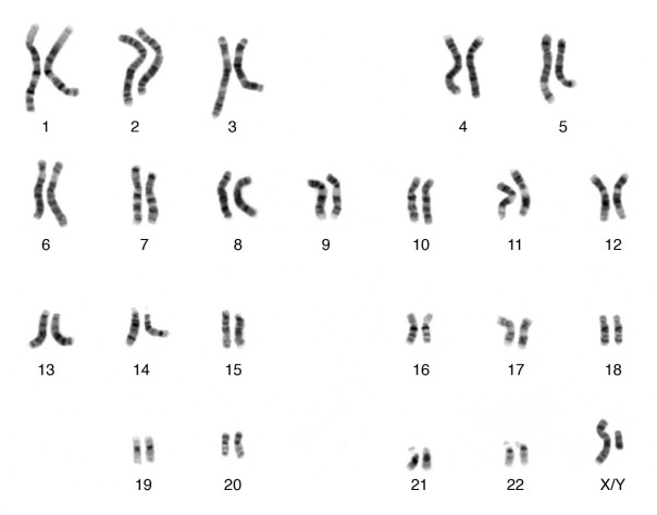 chromosomes-for-site